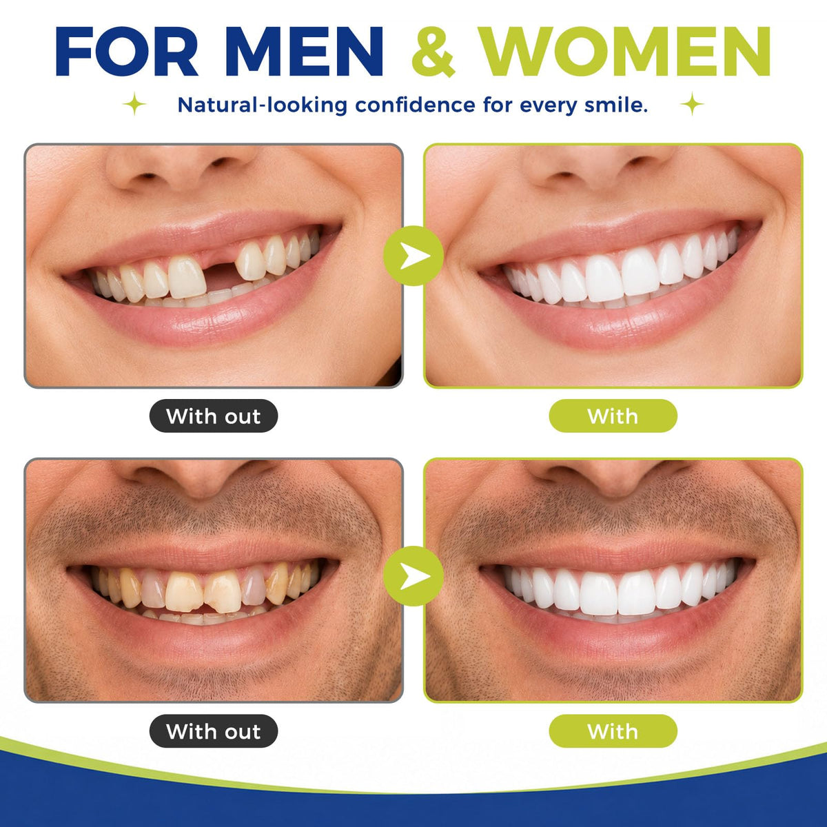 Formbar Silikone Falske Tænder Veneers, DIY Øvre og Nederste Midlertidige Tandprotese Kit til Kvinder Mænd-L1